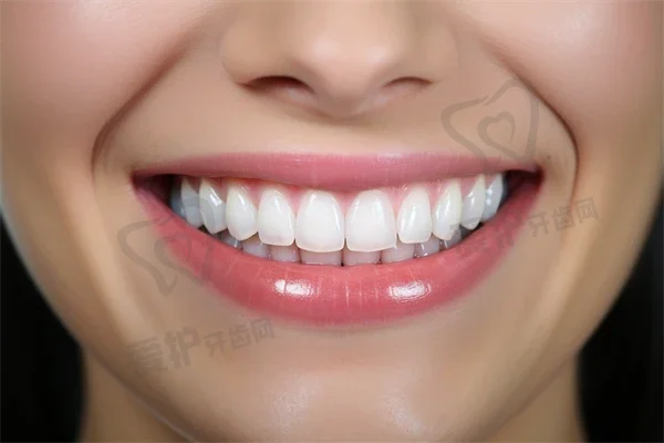 隐形矫正牙齿一般价格 隐形矫正牙齿流程是怎样的