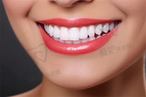 树脂填充牙齿多少钱一颗 树脂填充牙齿可以维持多久