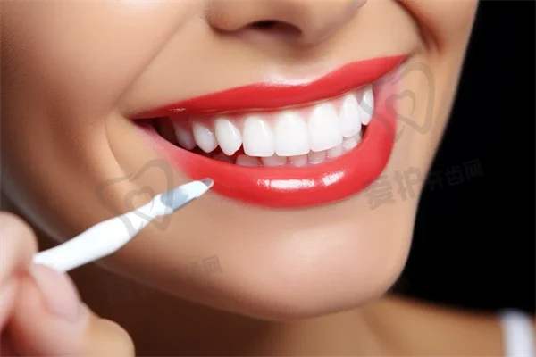 树脂填充牙齿多少钱一颗 树脂填充牙齿可以维持多久