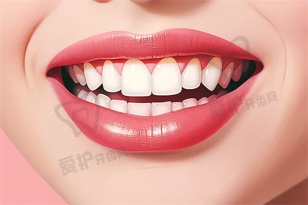 深圳赛德阳光口腔门诊部种植牙价格公布：半口/全口上门牙种植5556元~109825元之间
