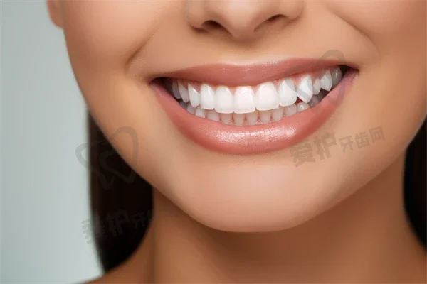 中年人种植牙口碑论述及牙齿缝隙大矫正技术分析