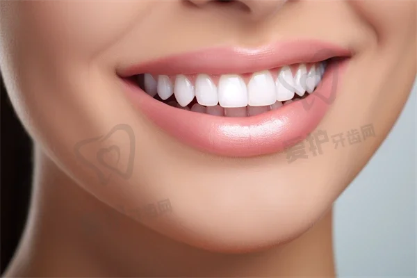 杭州云齿口腔医院种植牙费用详情：半口/全口纯钛种植牙44954元~143784元之间