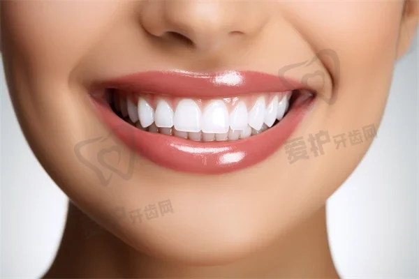 杭州云齿口腔医院种植牙费用详情：半口/全口纯钛种植牙44954元~143784元之间