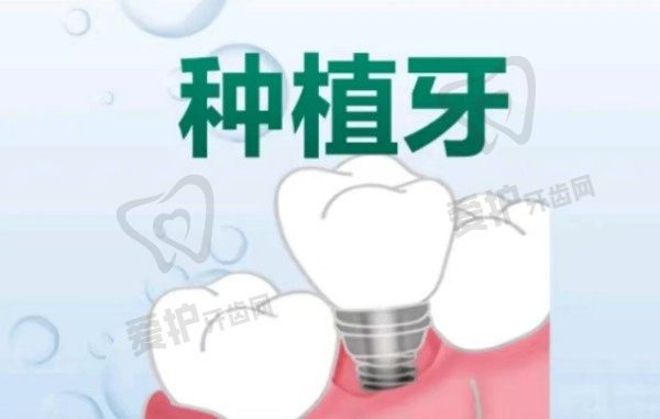 上海泰康拜博口腔医院瑞典诺贝尔PMC种植牙价格现优惠价5980元起，原价格20800元起，稳定性好适合多种骨质条件患者