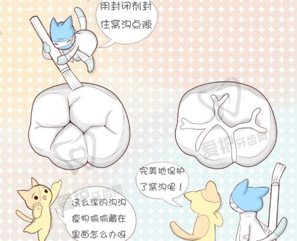 窝沟封闭的费用大约多少钱