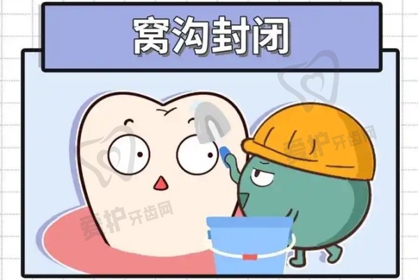 窝沟封闭的成效能维持多久