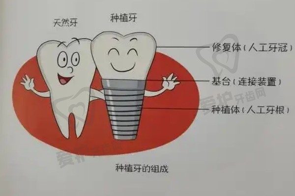 宜昌爱合口腔和宜昌吚呀口腔哪个好