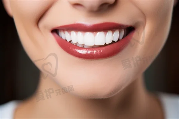 杭州富阳口腔医院种植牙费用一览：半口/全口诺贝尔pcc种植牙6084元~119812元之间