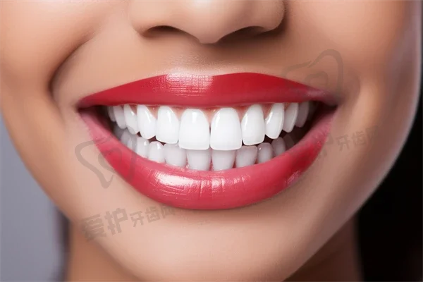 武汉最新口腔科医疗美容价格公布！青春百年医院推出热门活动：诺贝尔Active种植牙仅4599元，欧晴牙套矫正特惠价5599元！错过就要等一年！