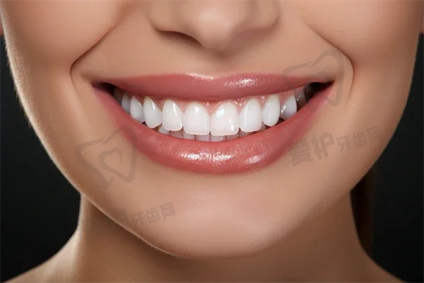哈尔滨一颗牙口腔门诊部矫正牙齿费用详情：陶瓷托槽牙齿矫正3360元到6562之间