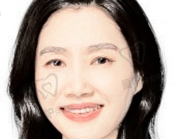 龙琴