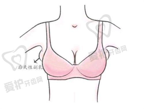 广州韩妃李光琴媚眼修复项目具体优势