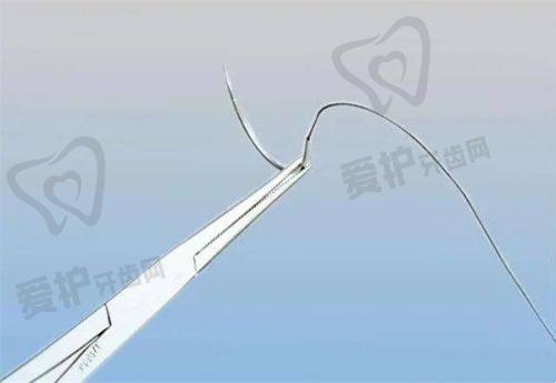 成都艺星乳房下垂矫正项目特色优势