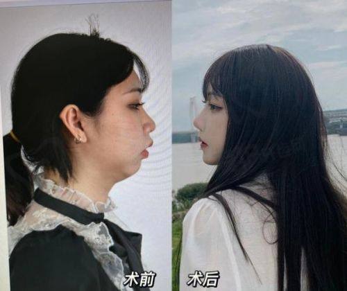 哈尔滨治疗疤痕增生好的医院推荐