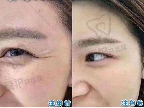 选择重庆华美整形外科医院的理由