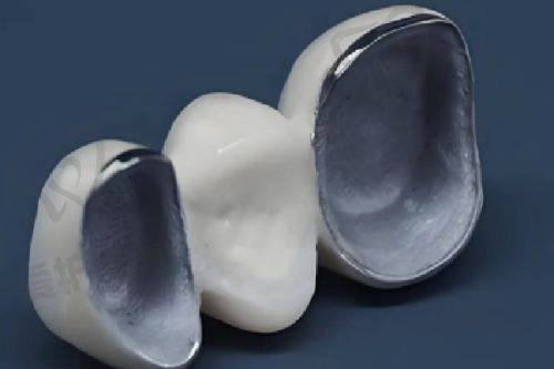 西昌春城口腔舒适化松动牙拔除项目顾客口碑
