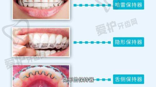西昌春城口腔舒适化松动牙拔除项目本身的特色优势