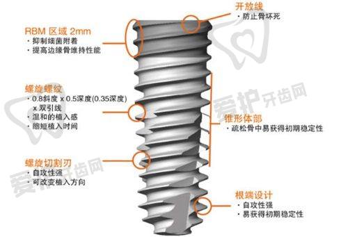 西昌春城口腔3MZ250树脂补牙项目的具体优势