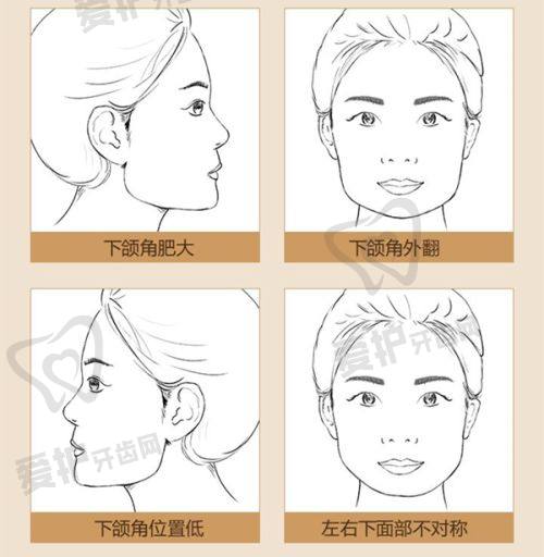 烟台鹏爱佳妍美容整形医院的优点