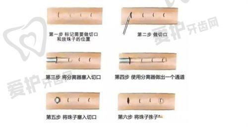 10、北京协和医院毛发移植中 心
