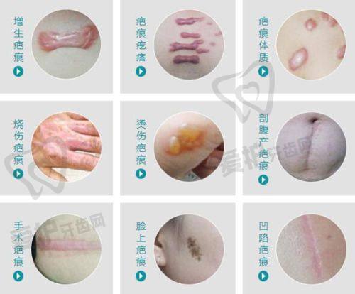 西安艺星医疗美容医院靠谱吗？