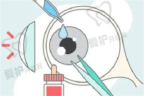 山东聊城爱尔眼科医院提供哪些治疗服务