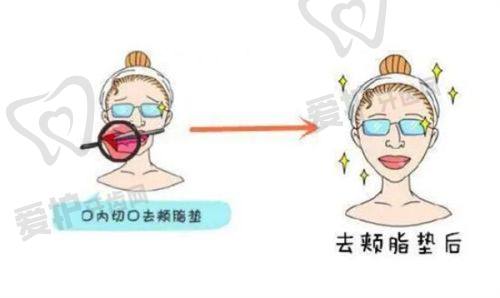 烟台鹏爱佳妍美容整形医院胡一九敏感肌中胚层疗法项目特色优势