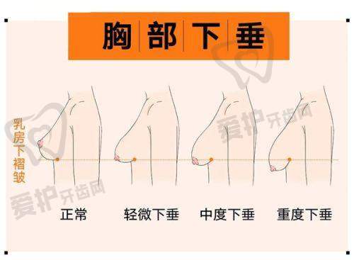 3. 郑州华 山整形医院