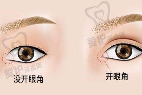 郑州王杨医生收费高吗