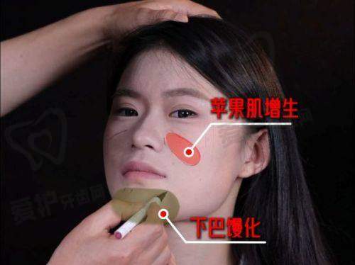 徐威强医生怎么预约挂号
