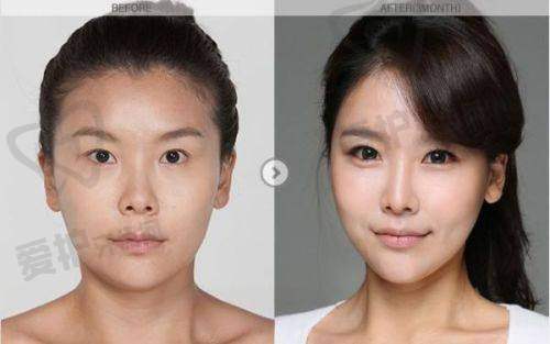 顾客对陈德法副乳清除项目的口碑
