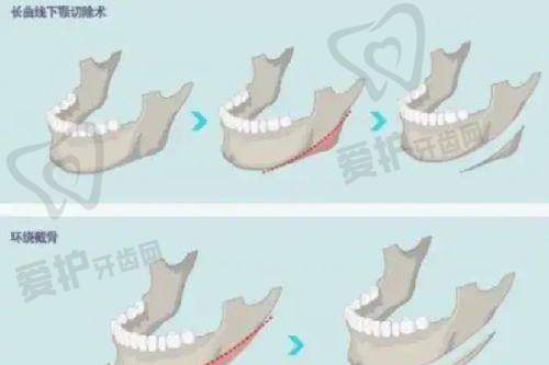 广东韩妃整形外科医院杨熙雯医生怎么预约挂号