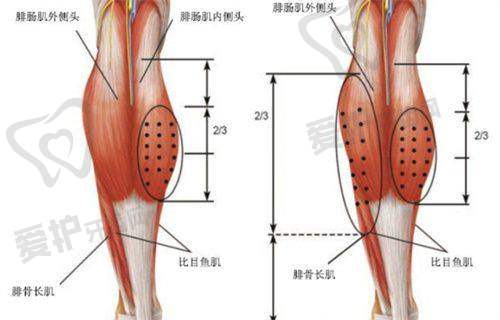 王旭明医生做鼻子价格