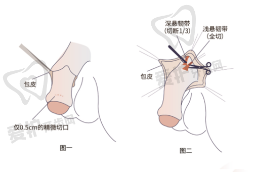 广东韩妃整形外科医院柳超医生技术特色