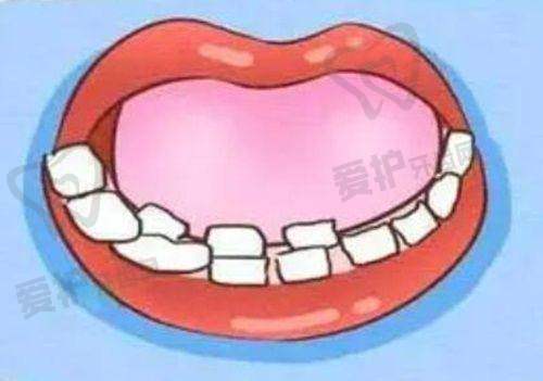 北京牙元素口腔骗局揭秘视频