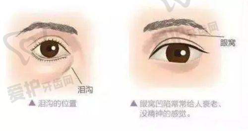 艾伟健医生怎么预约挂号
