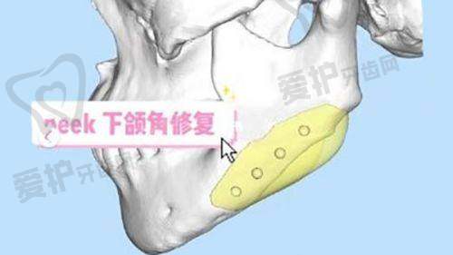 耿继红医生怎么预约挂号