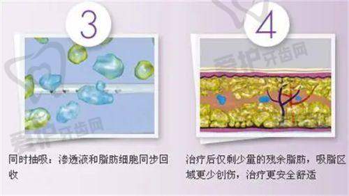 深圳源美医疗美容门诊部医生团队介绍