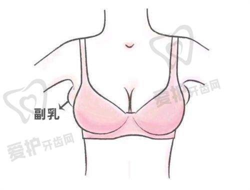 医院/医生做自体脂肪丰胸项目的具体优势