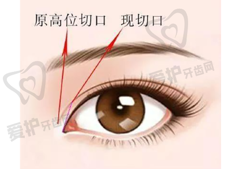 深圳美博瑞医疗美容门诊部预约方式