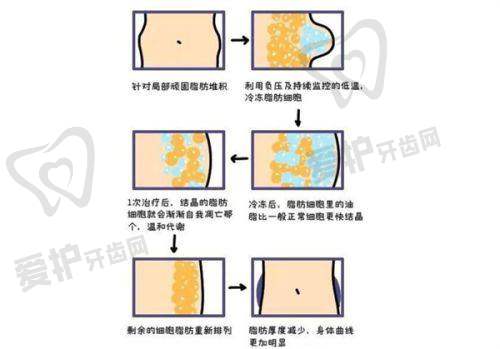 李超医生介绍