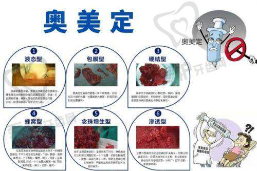 深圳美博瑞医疗美容门诊部收费价格表