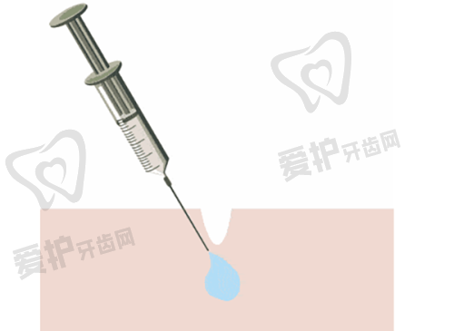 宋彦医生擅长项目