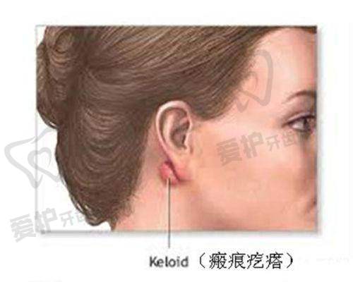 重庆华美整形外科医院做自体脂肪全脸填充的优势