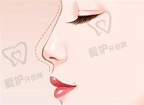 沈绍勇医生技术特色