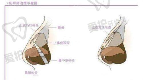宋彦医生真实的患者口碑评价