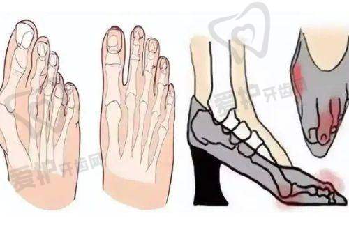 热拉提plus双模式的优势特点