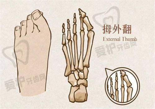 医院及医生做下颌缘吸脂项目的优势