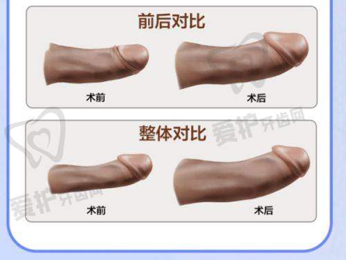 详细解读<span style=