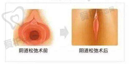 杭州艺星整形价格表大揭秘 - 胸部整形收费价目表